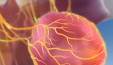 Sacral nerve stimulation