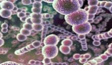 Streptococcus pneumoniae