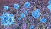 T cells attacking tumor cells