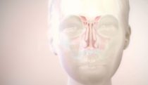 Revealing the sinuses
