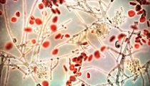 Fungal infection in the blood